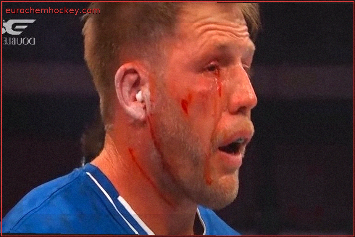 Jake Hager Injured in Power Slap Bout